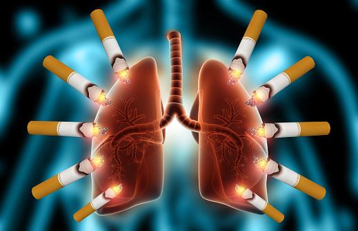 Hệ hô hấp là một trong những cơ quan chịu ảnh hưởng nghiêm trọng của khói thuốc lá